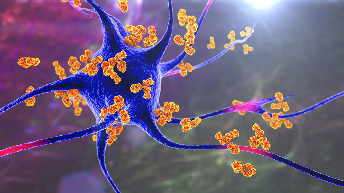 Computer illustration of autoimmune diseases