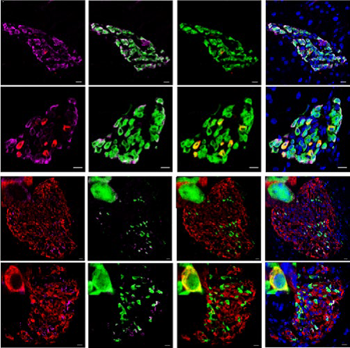 Breakthrough T1D-Funded Researchers Reprogram Human Alpha Cells to Produce Insulin