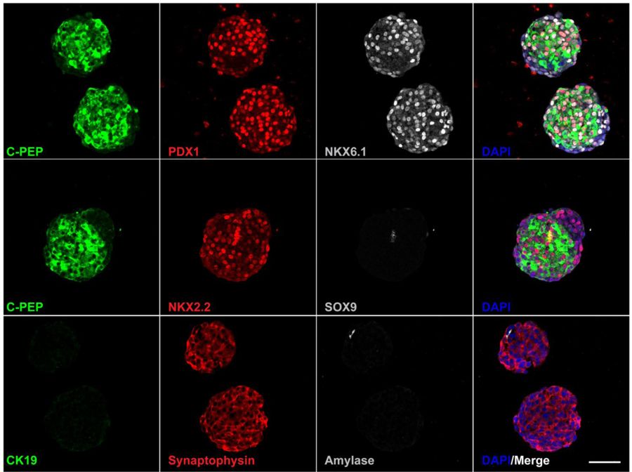 Stem Cells to Beta Cells for Insulin Therapy: One Step Forward by Breakthrough T1D-Funded Researchers