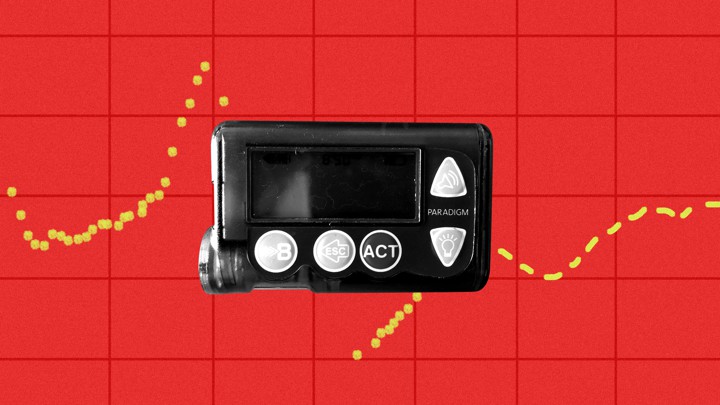 A DIY Approach to Artificial Pancreas Technology