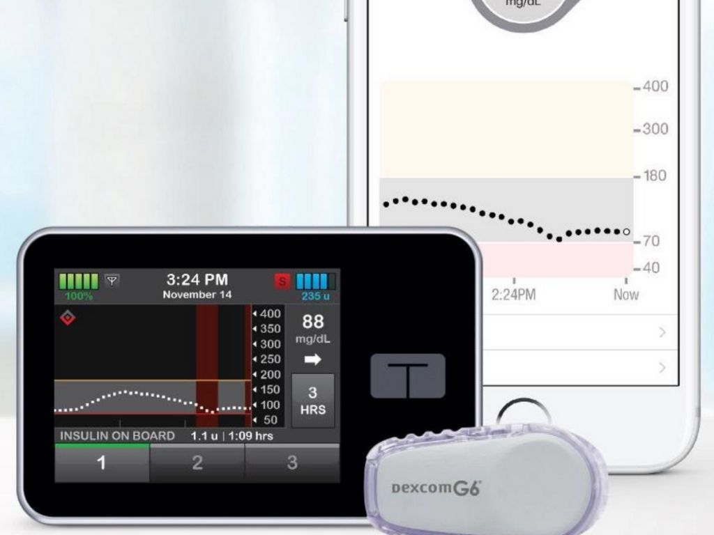 Tandem Control-IQ Controls T1D in Children Ages 6 and Up