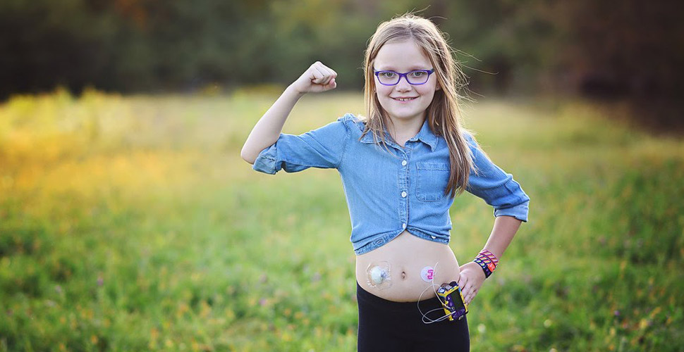 Young girl shows off her artificial pancreas system