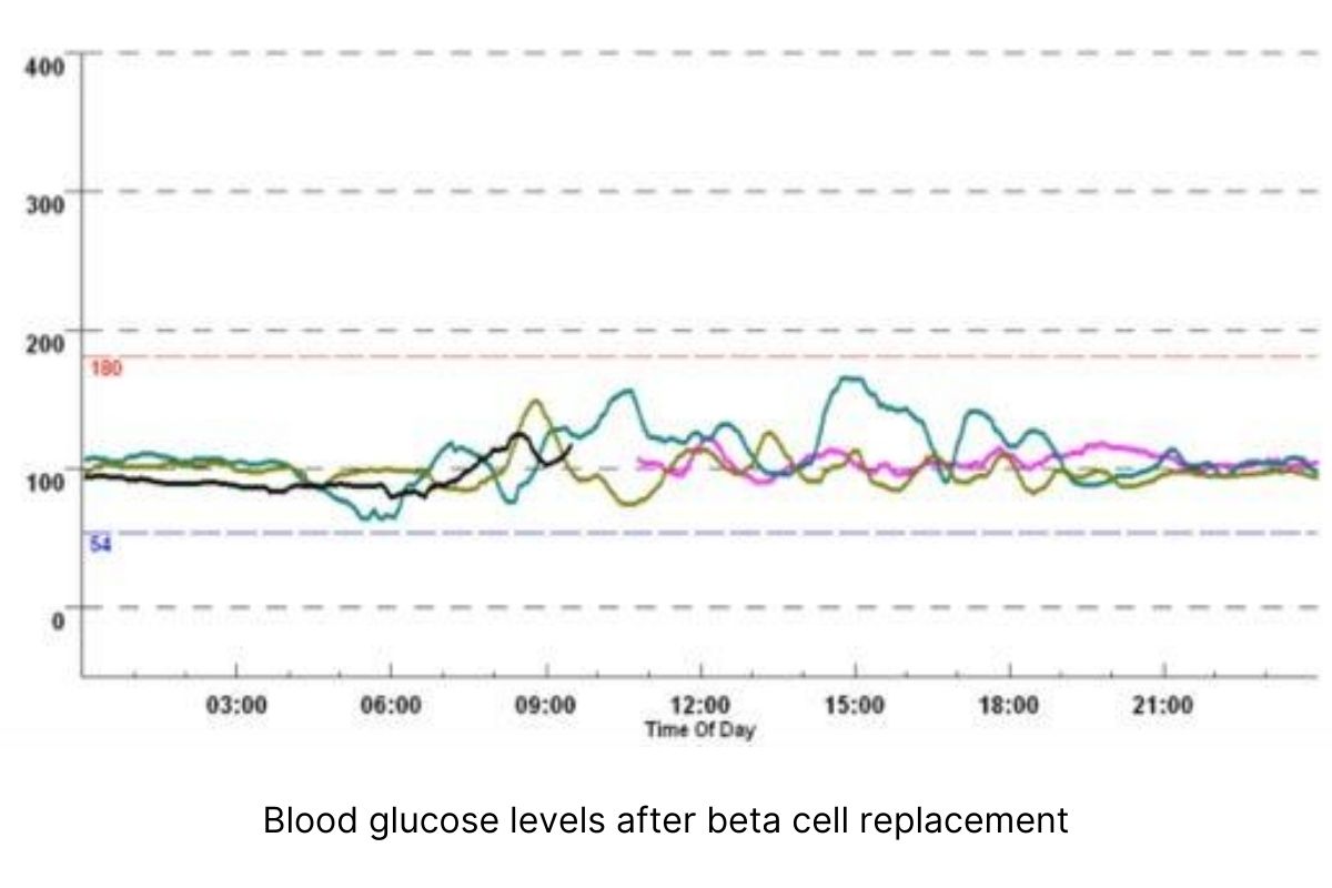 Cell Therapy Approaches Moving Along the Pipeline