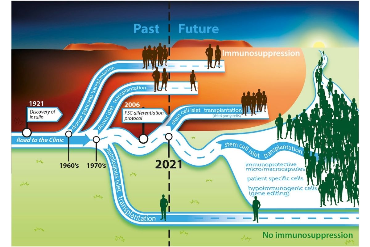 Road trip of islet replacement therapy - Cell Stem Cell 2021